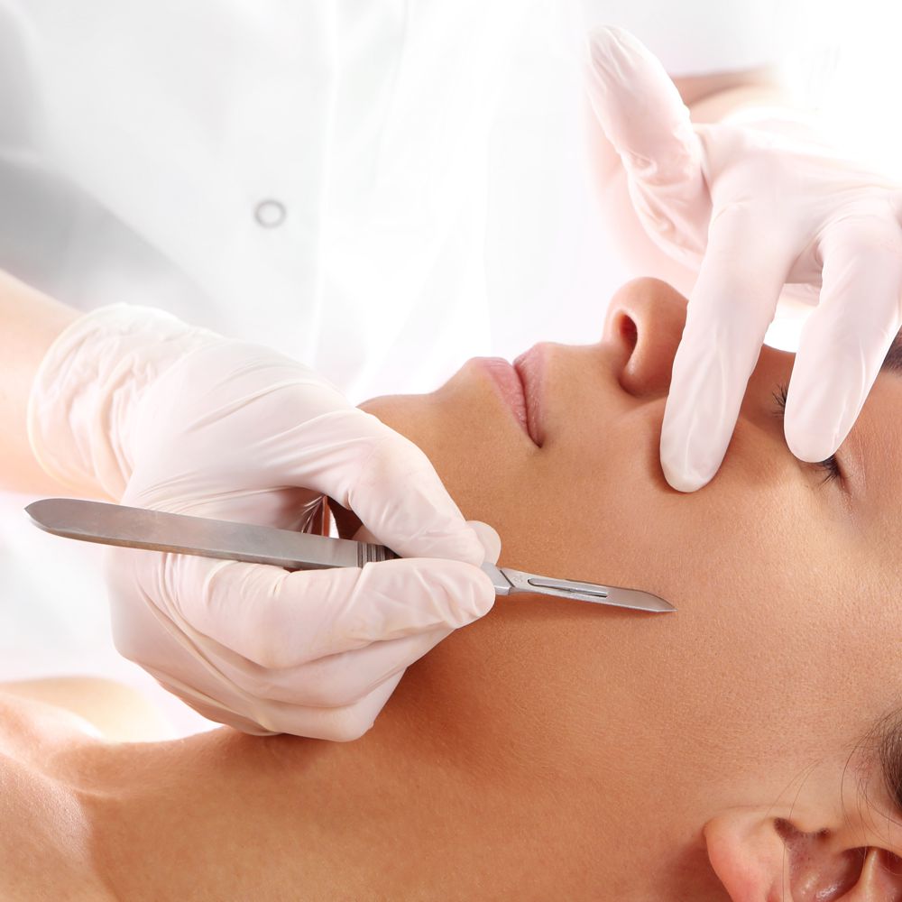 dermaplaning