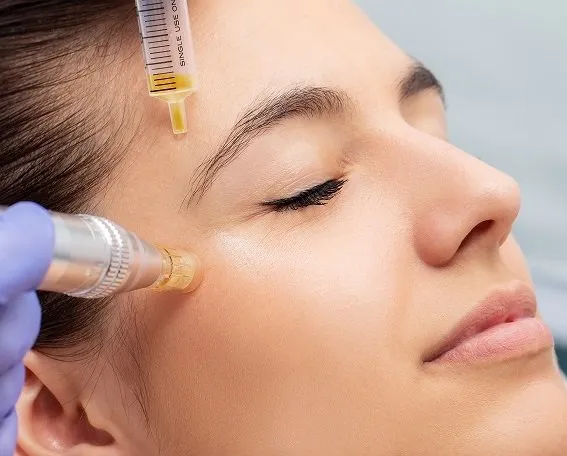 Tratament de microneedling pe față